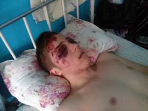  11-1